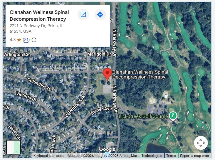Clanahan Wellness Spinal Decompression Therapy